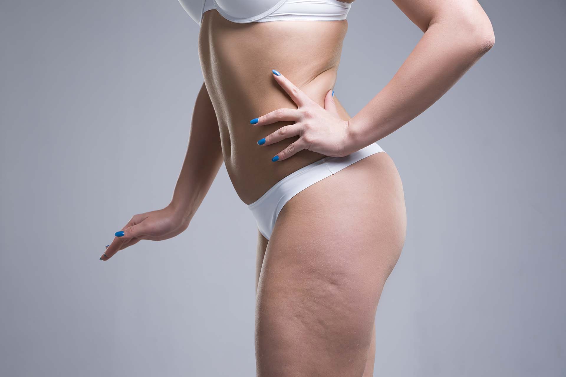 Cellulite Reduction in Frisco, TX
